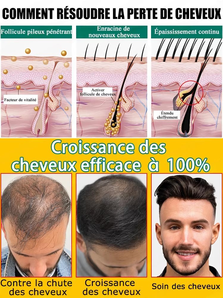 Daily Ginger Scalp Nourish Liq - Hair Care For Hair Fall 评论和价格