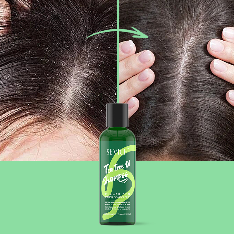Tea Tree Essence Shampoo Hair  - Hair Care Conditioner 评论和价格