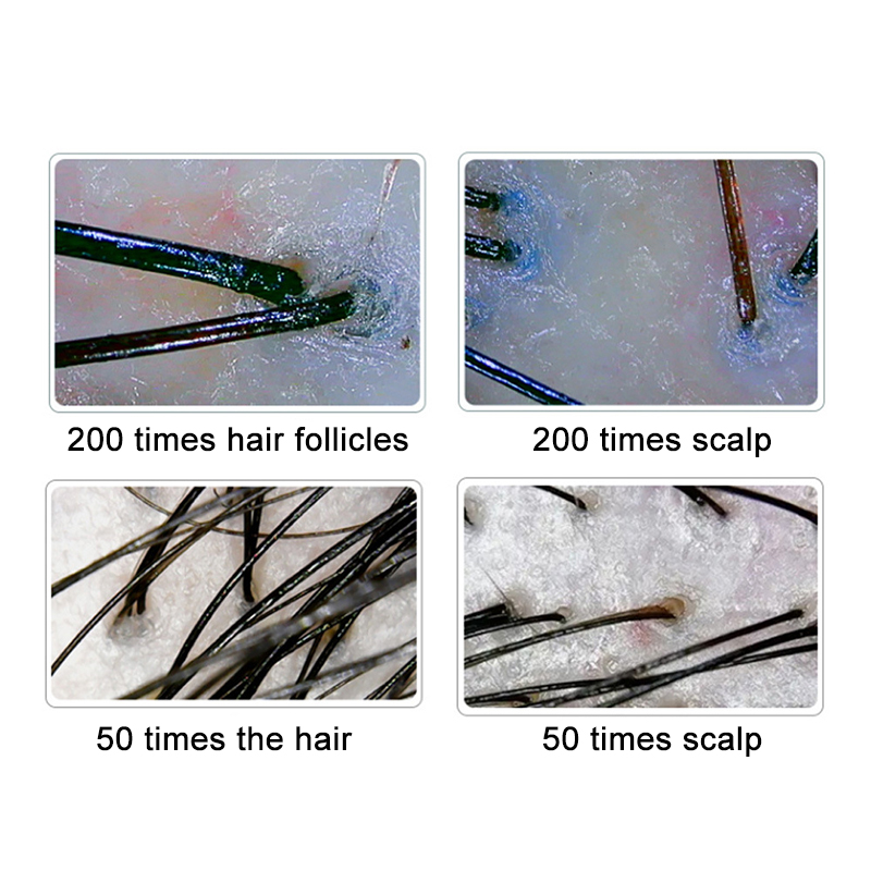 200/50X Skin Hair Scalp Detect - Hair Porosity Test 评论和价格