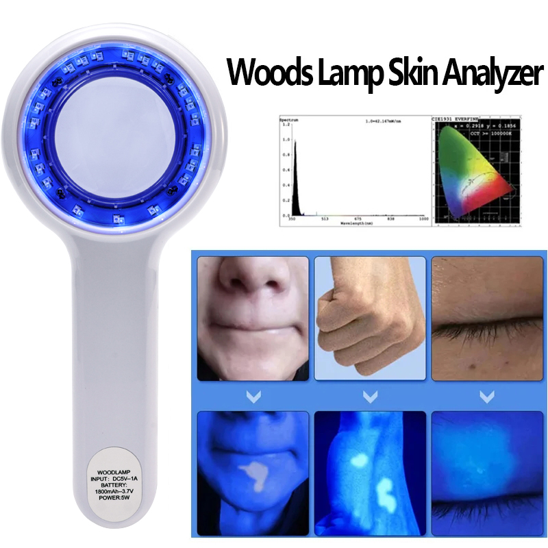 NEW Woods Lamp Skin Analyzer P - Hair Porosity Test 评论和价格