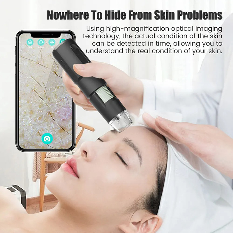 Wireless Dermatoscope Scalp Sk - Hair Porosity Test 评论和价格